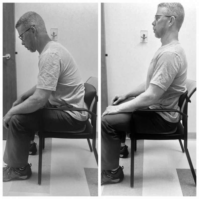 posture correction